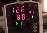 VS800 RESP NIBP SPO2 Digunakan Monitor Pasien Monitor Jantung Mindray